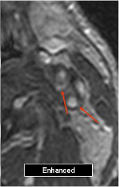 2006 03 03 15 09 49 706