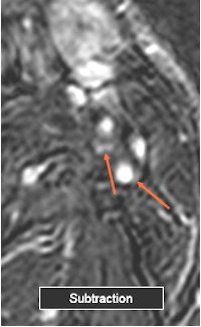 2006 03 03 15 10 03 706