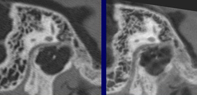 2006 03 07 10 55 07 706