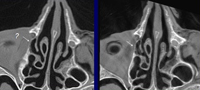 2006 03 07 10 55 31 706