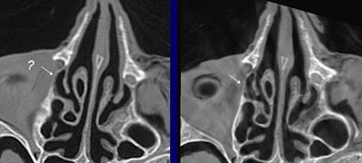 2006 03 07 10 55 31 706