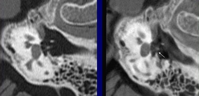 2006 03 07 10 55 56 706