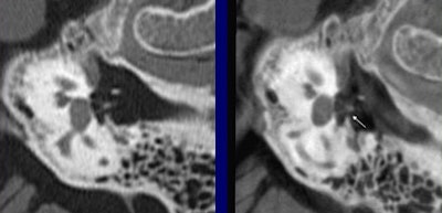 2006 03 07 10 55 56 706