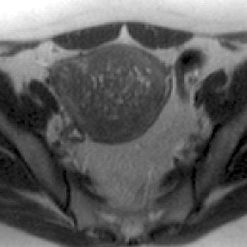 2006 03 14 16 18 05 706