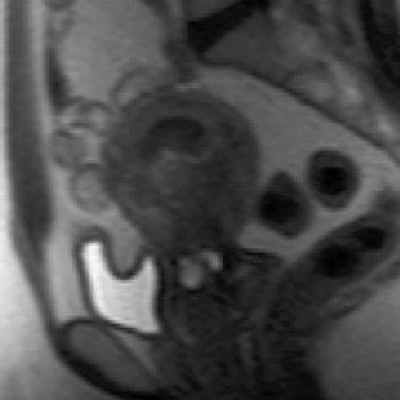 2006 03 14 16 18 24 706