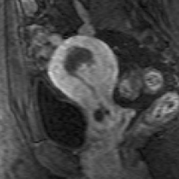 2006 03 14 16 19 25 706