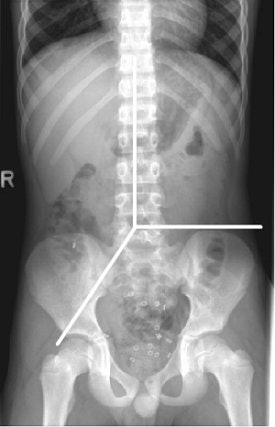 2006 03 15 11 04 27 706