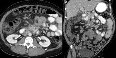 2006 03 21 14 44 09 706