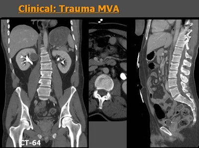 2006 03 21 14 44 29 706