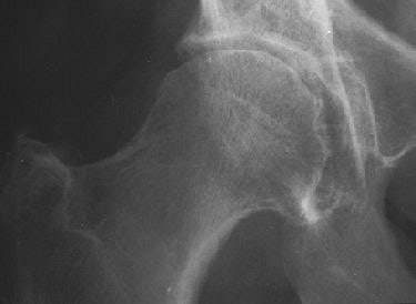 2006 03 27 11 15 05 706