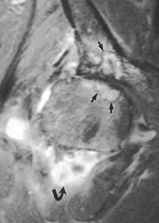 2006 03 27 11 15 18 706