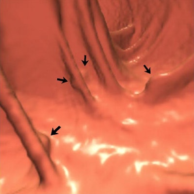 2006 04 11 15 31 26 706