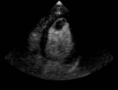 2006 04 17 15 08 39 706