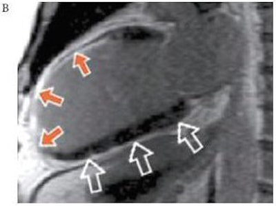 2006 04 17 15 26 55 706