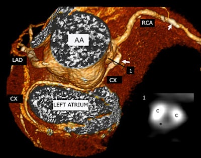 2006 04 19 14 32 39 706