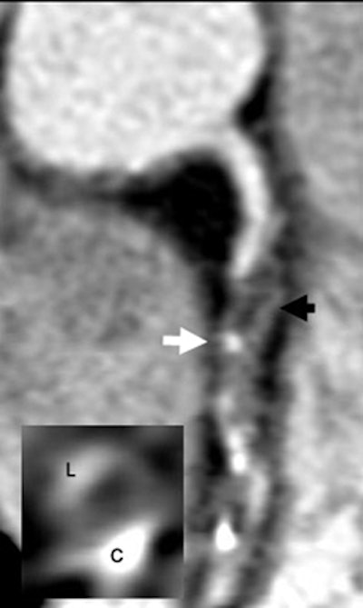 2006 04 19 14 33 42 706