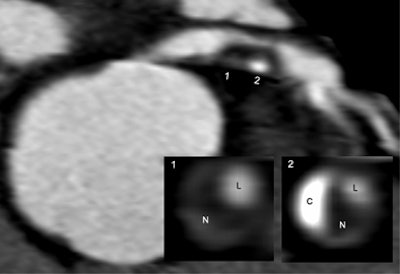 2006 04 19 14 33 58 706