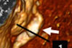 2006 04 19 14 34 12 706