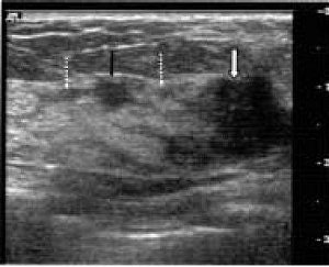 2006 04 28 15 36 00 706