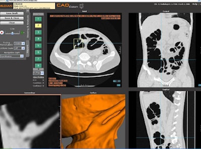 2006 05 04 11 20 16 706