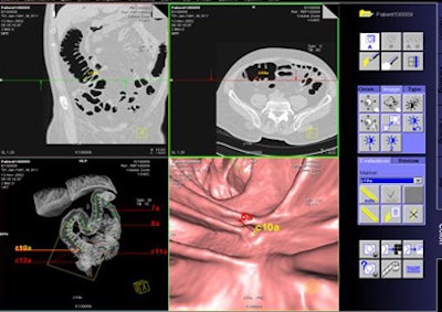 2006 05 08 09 47 56 706