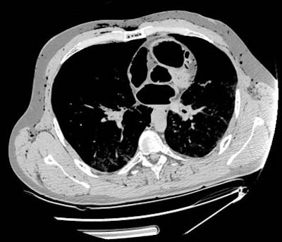 2006 05 17 11 11 14 706