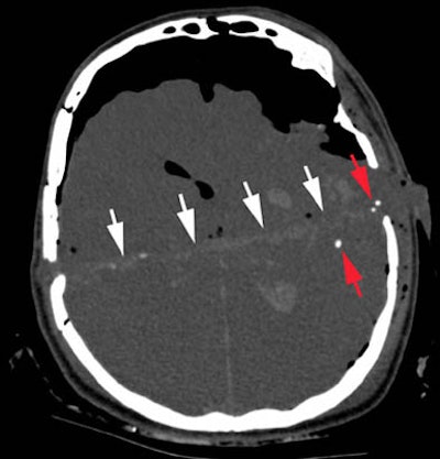 2006 05 17 11 11 29 706