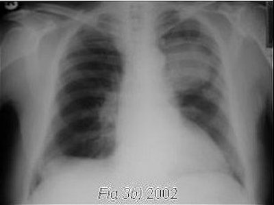 2006 06 02 16 14 47 706