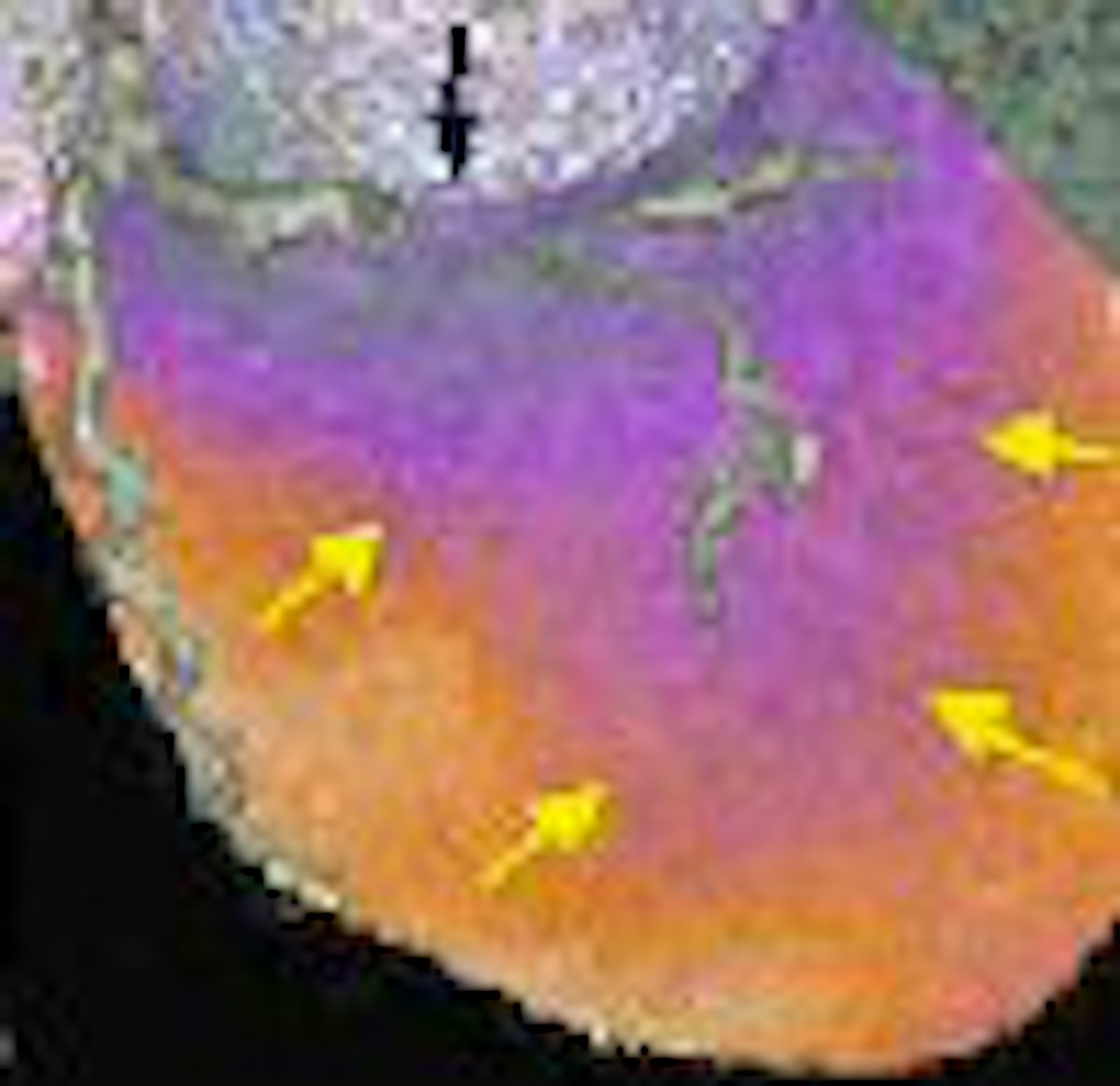 Cardiac SPECT/CT fusion captures SNM's Image of the Year | AuntMinnie
