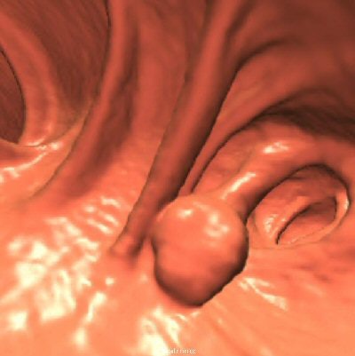 2006 06 07 14 10 46 706