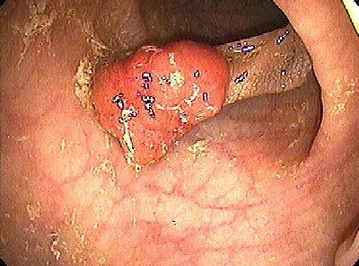 2006 06 07 14 11 02 706