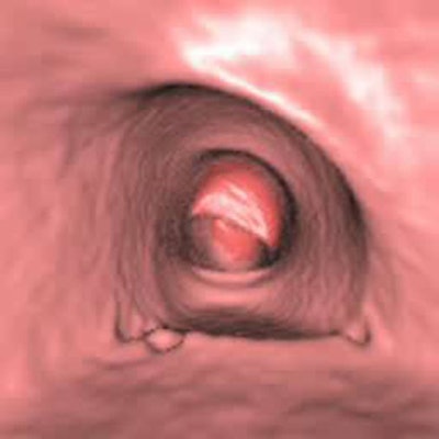 2006 06 09 13 42 06 706