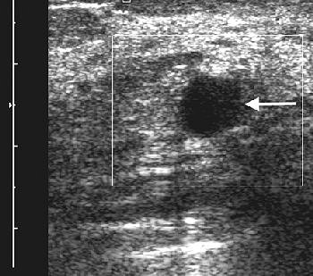 2006 06 12 09 46 54 706