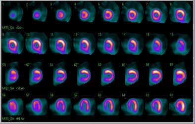 2006 06 14 11 51 00 706