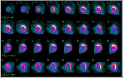 2006 06 14 11 51 00 706