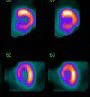 Spectrum Dynamics prepares launch of D-SPECT cardiac gamma camera ...
