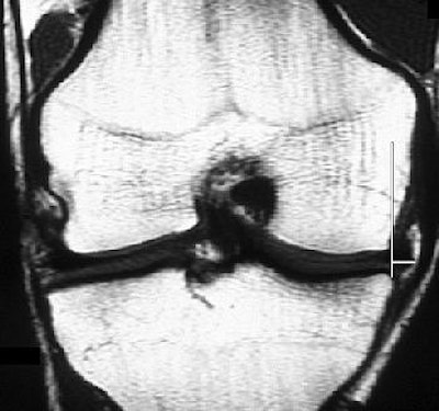 2006 06 22 15 14 58 706