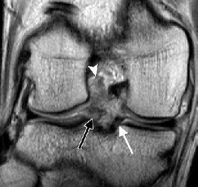 2006 06 22 15 15 10 706