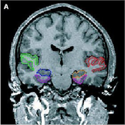 2006 06 23 14 15 05 706