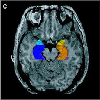 2006 06 23 14 19 11 706