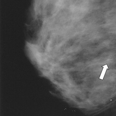 2006 06 30 11 23 52 706