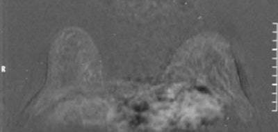 2006 06 30 11 24 18 706