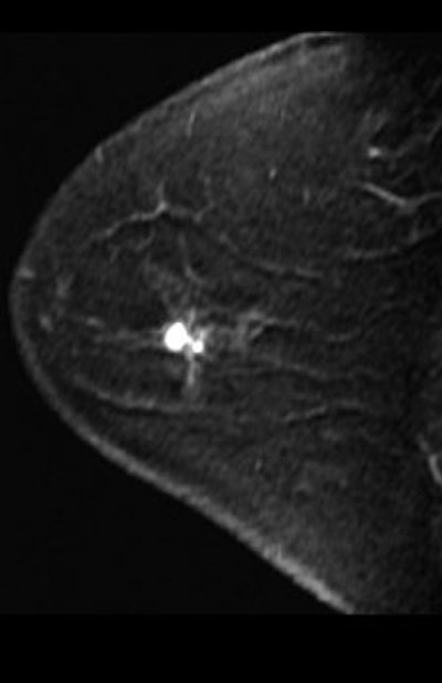 2006 06 30 11 24 31 706