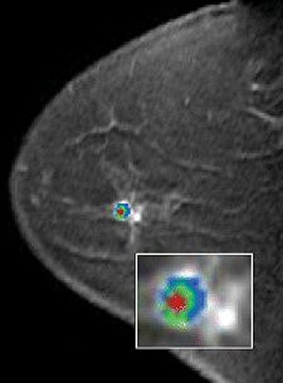 2006 06 30 11 24 55 706