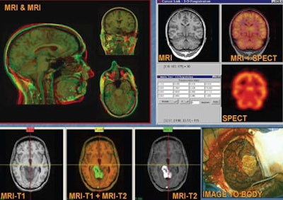 2006 07 03 17 22 53 706