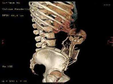 2006 07 06 17 09 33 706