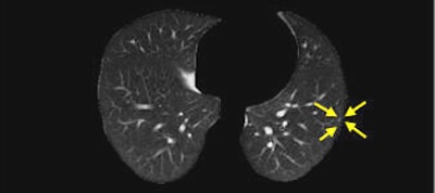 2006 07 18 16 16 42 706