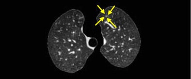 2006 07 18 16 16 55 706