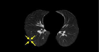 2006 07 18 16 25 51 706