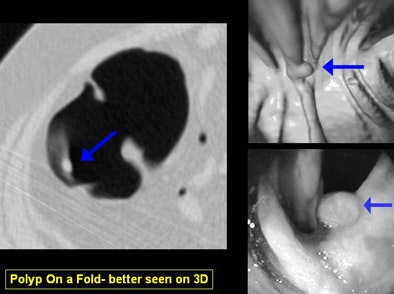 2006 07 21 16 16 00 706